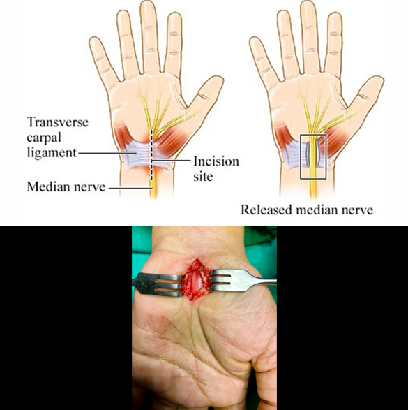 thumb col-md-6