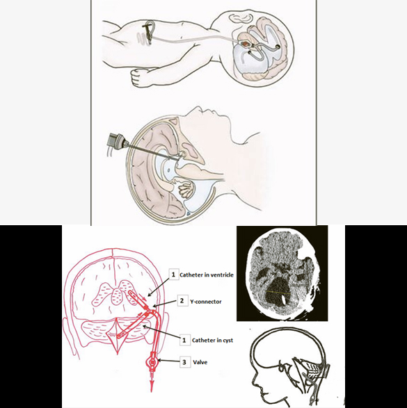 thumb col-md-6