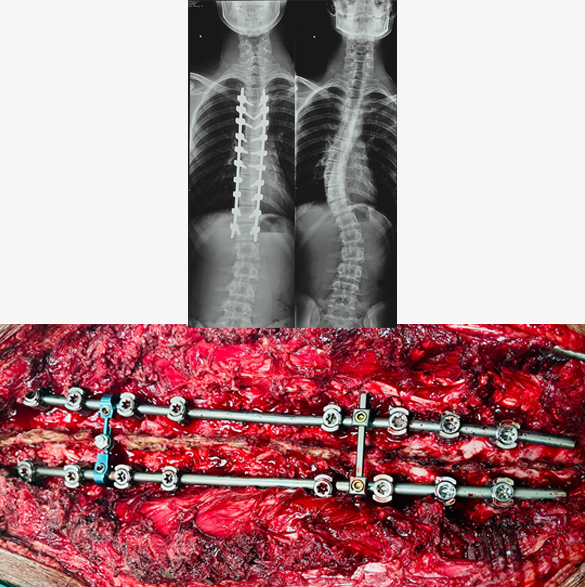 thumb col-md-6