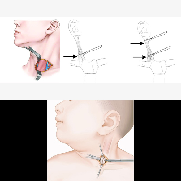 thumb col-md-6