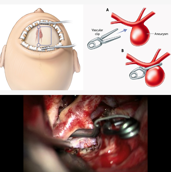 thumb col-md-6