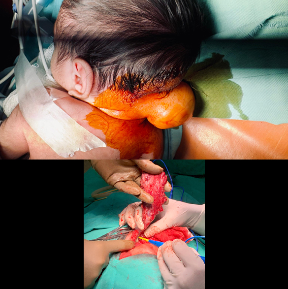 thumb col-md-6