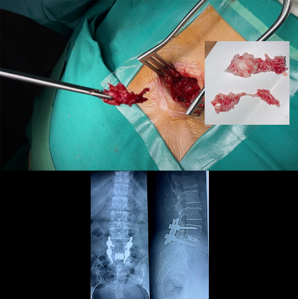 thumb col-md-6