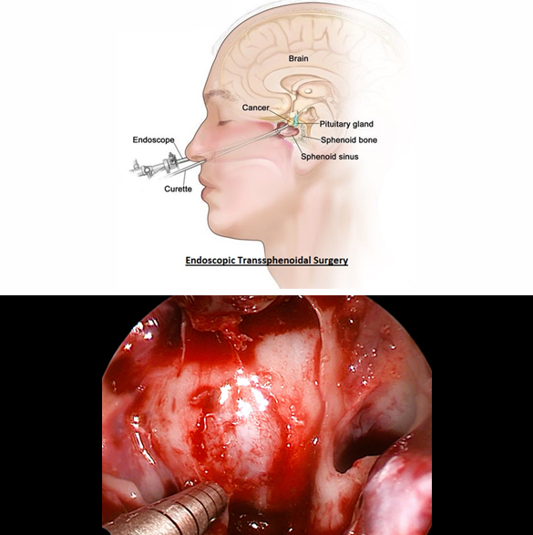 thumb col-md-6